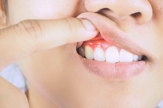 What causes receding gums? A complete guide