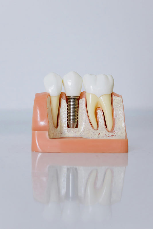 The Peri-Implantitis Microbiome: A Review